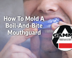 How to Mold a Boil-and-Bite Mouthpiece